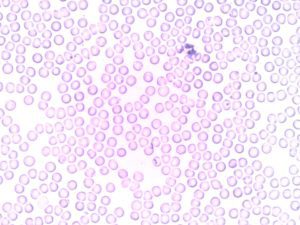 ketosis immune system